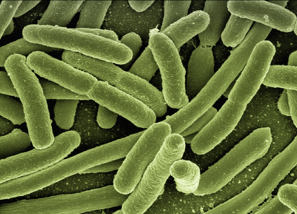 koli_bacteria_escherichia_coli_bacteria